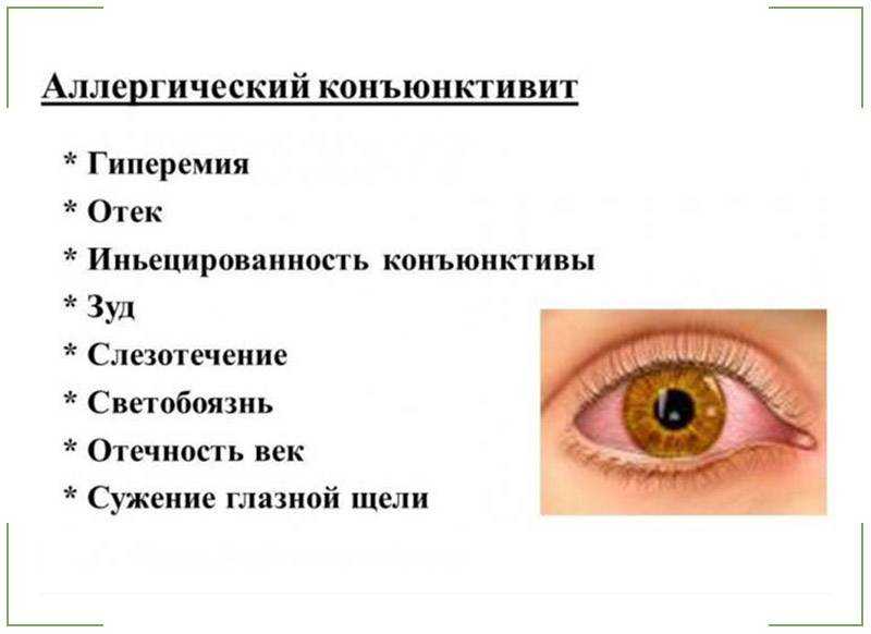Конъюнктивит у ребенка, лечение и профилактика