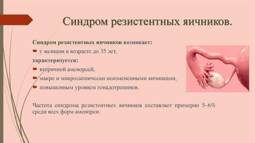 Преждевременная недостаточность яичников