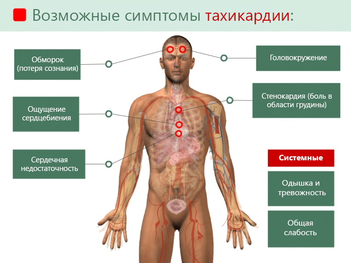 Одышка при физических нагрузках!