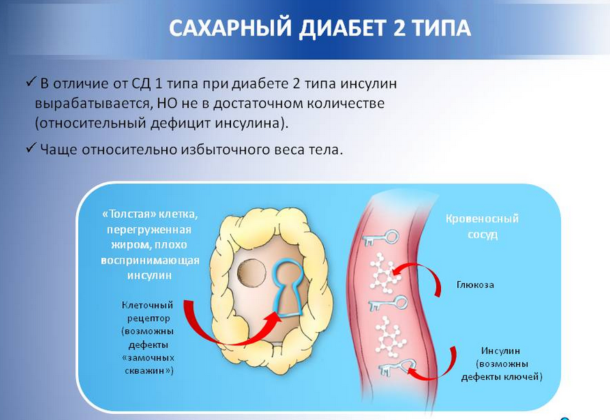 Диагноз: сахарный диабет. симптомы, осложнения и лечение