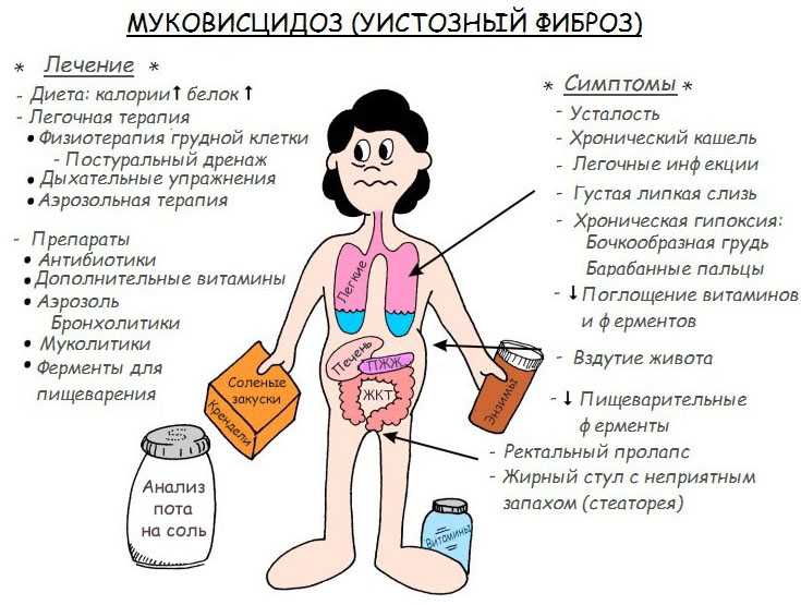 Муковисцидоз, что это? причины, симптомы у детей, лечение