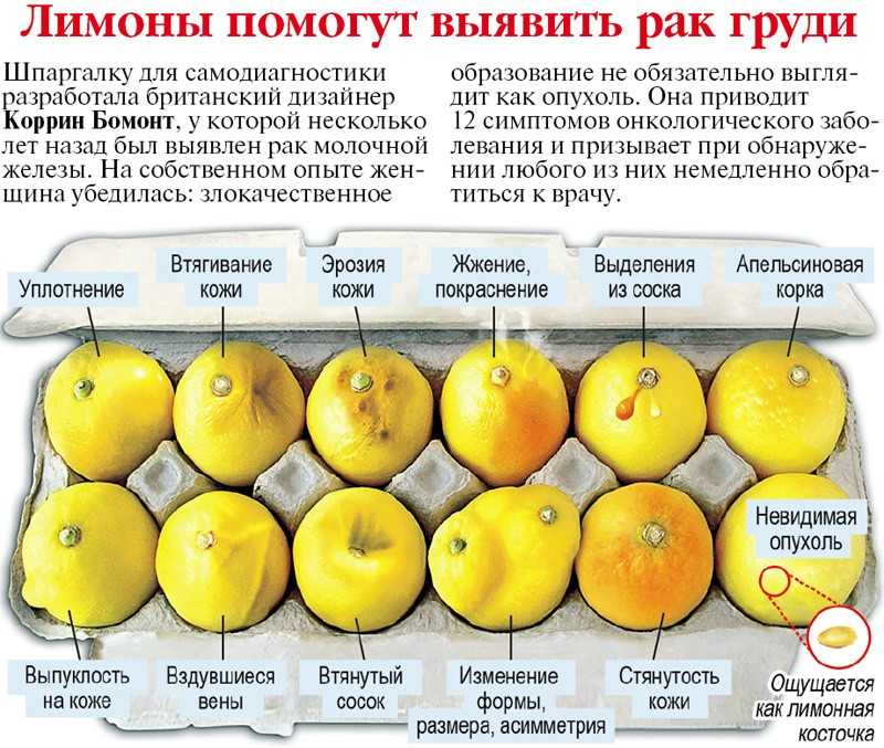 Рак молочной железы (рак груди): стадии, симптомы и лечение - напоправку – напоправку