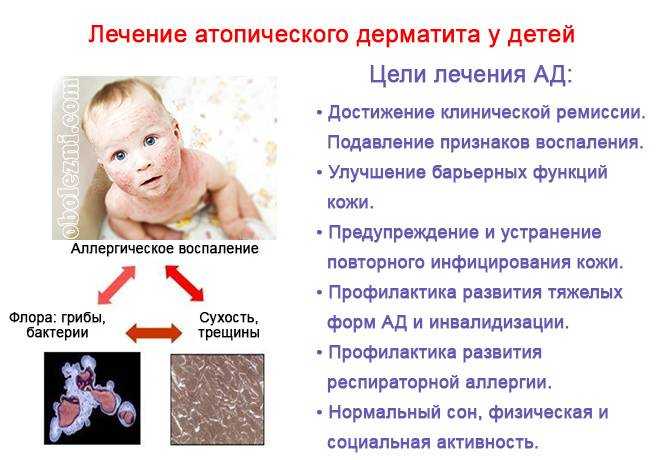 Аллергический дерматит у грудного ребенка | 1дмц