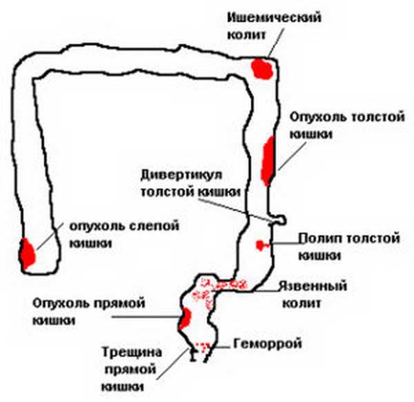 Копрограмма: нормы, расшифровка, правила подготовки