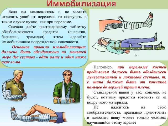 Открытый и закрытый перелом ключицы со смещением, симптомы