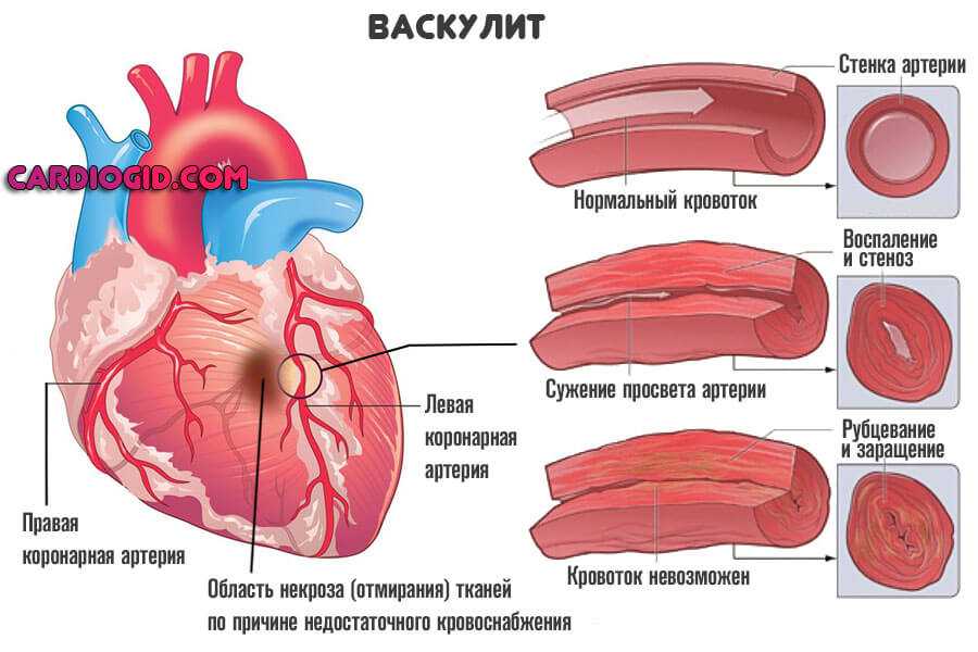 Соответствующие сосуды