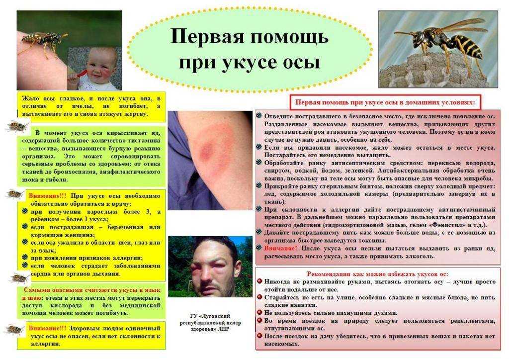 Укус осы
