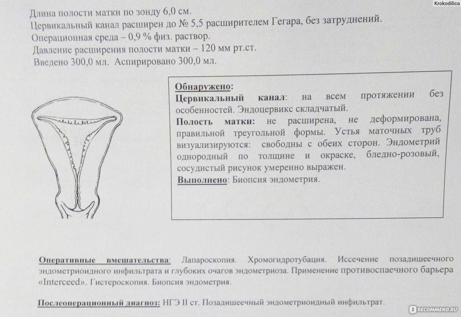 Анализ биопсия эндометрия