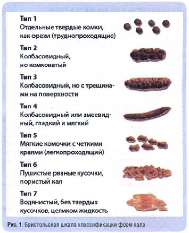 Бесцветный стул