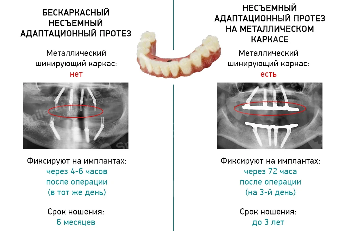 На какой день имплантация. Имплантация этапы и сроки. Сроки имплантации зубов. Этапы имплантации и протезирования зубов.