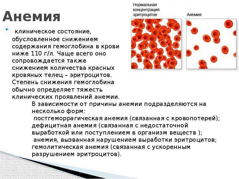 Дефицит железа: общие признаки