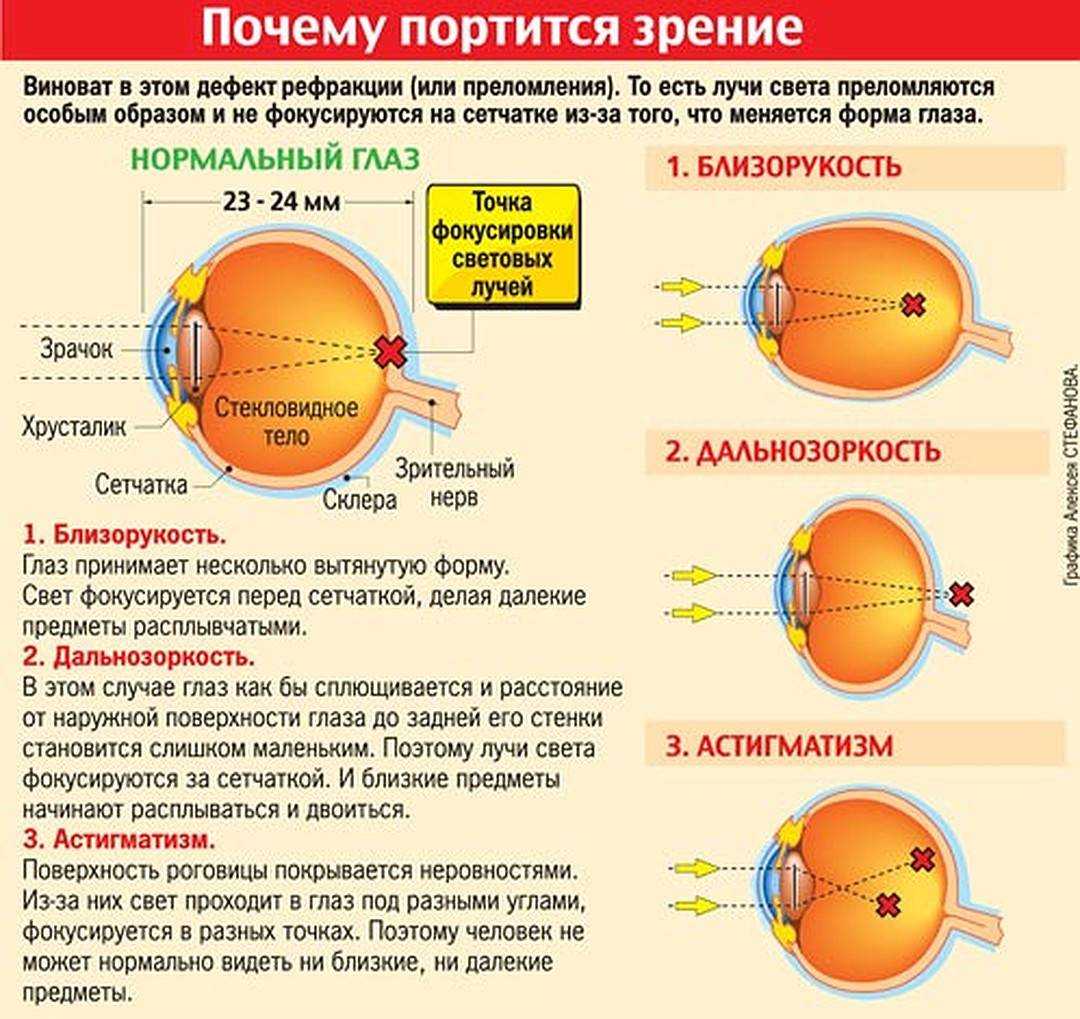 Вредит ли компьютер зрению: насколько портятся глаза и как их сохранить при долгой работе за монитором