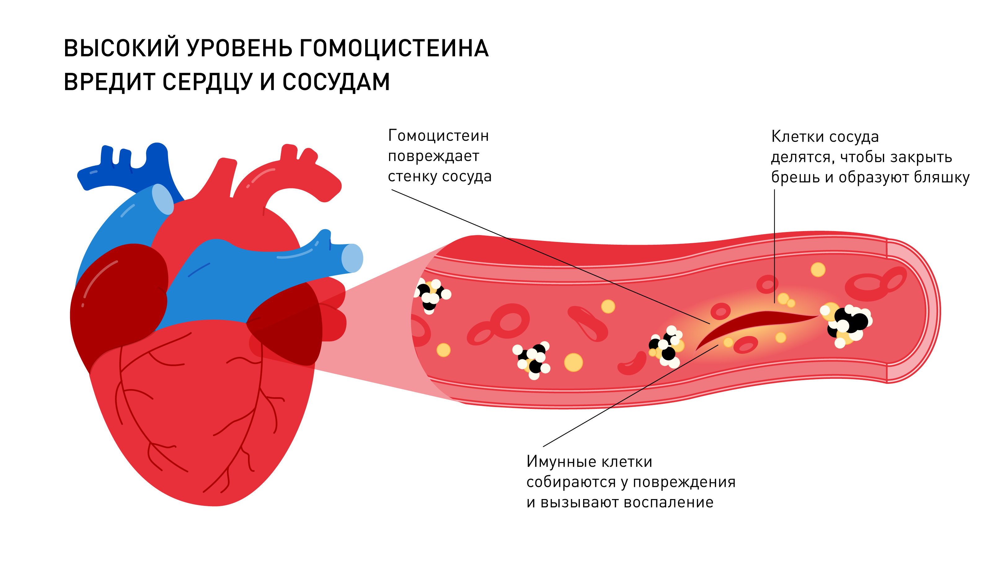 Норма холестерина в крови
