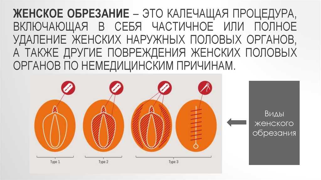 Риск венерической инфекции ниже на 60-70%. говорим с урологом про обрезание
