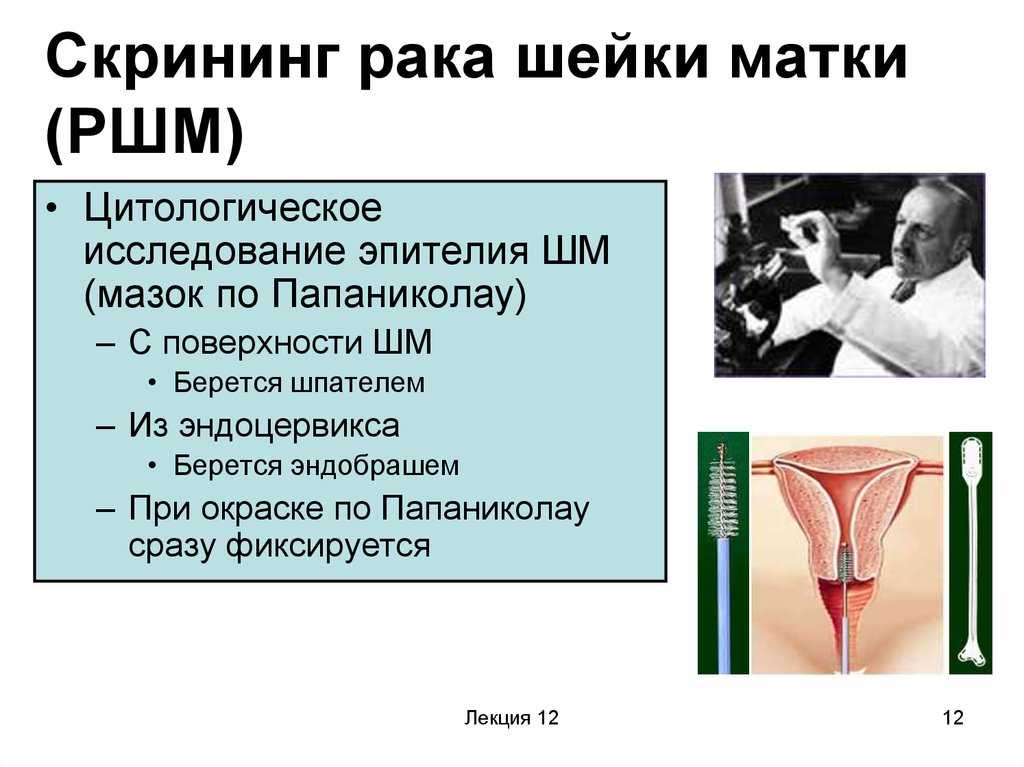 Скрининг рака шейки матки