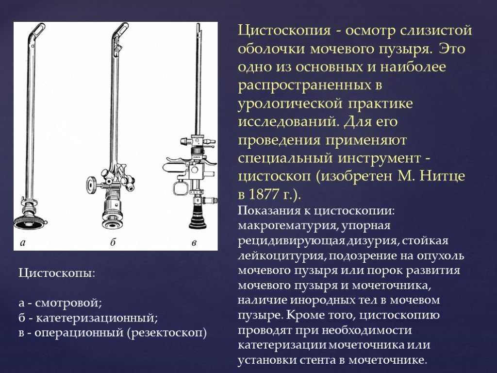Правильная подготовка к цистоскопии: как получить точный результат | университетская клиника