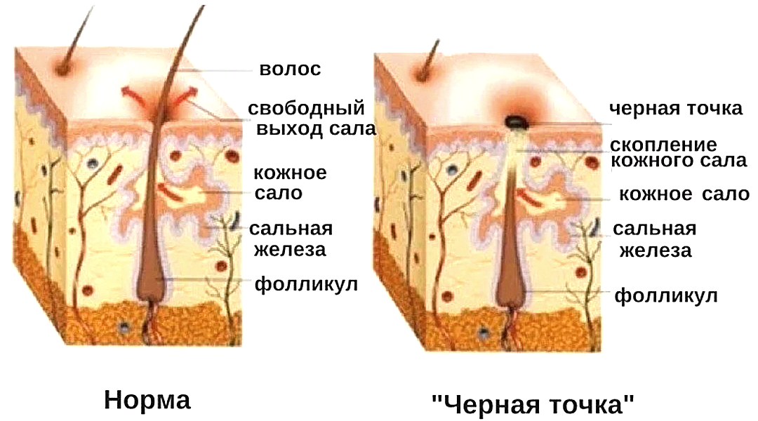 Как нарисовать прыщи на лице