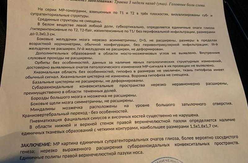Влияние коронавируса на мозг и нервную систему человека - кгбуз горбольница №12