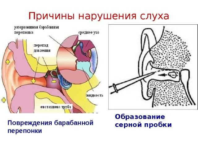 Причины почему возникает сердцебиение в ушах