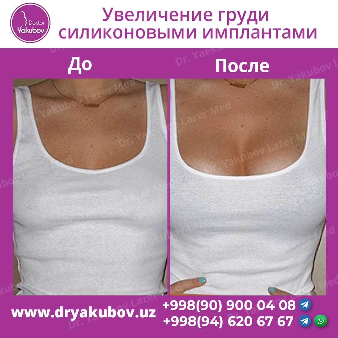 Как проходит консультация в клинике пластической хирургии? - beauty doctor
