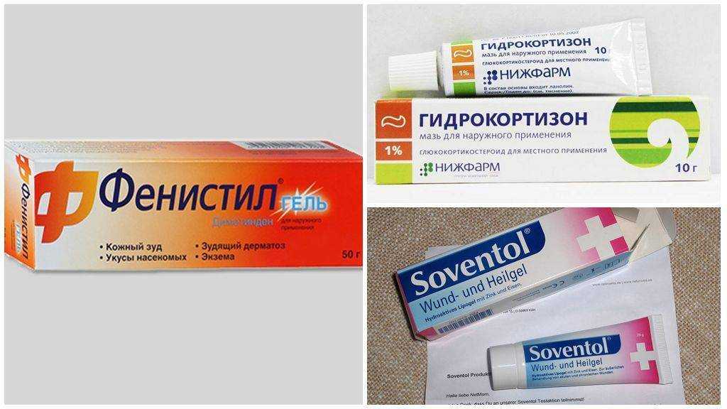 Умирает ли оса после укуса? как вытащить жало осы?