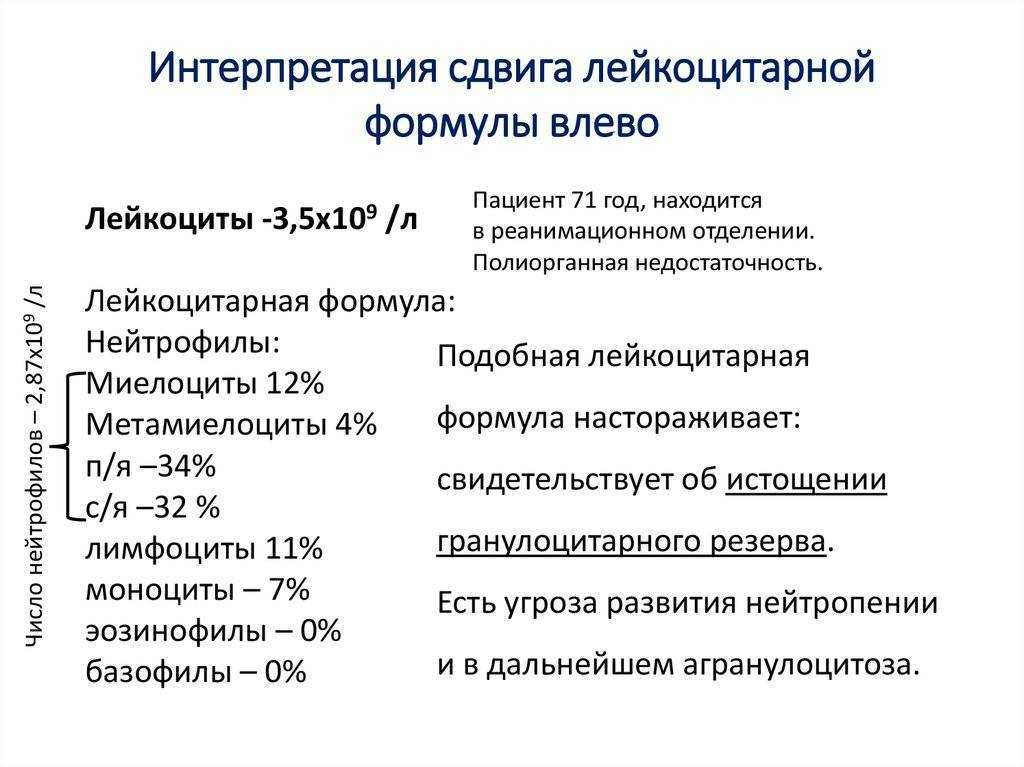 Базофилия: симптомы, причины, последствия
