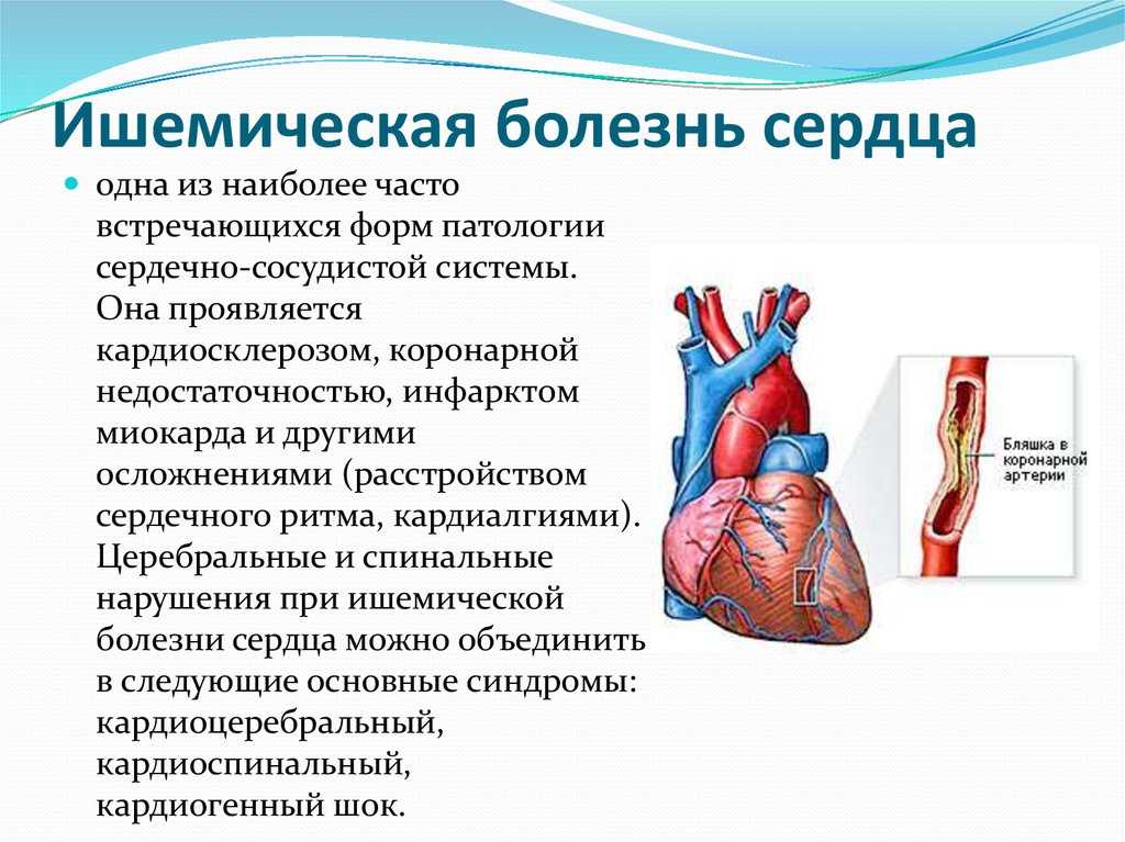 Какие болезни лечит кардиолог?