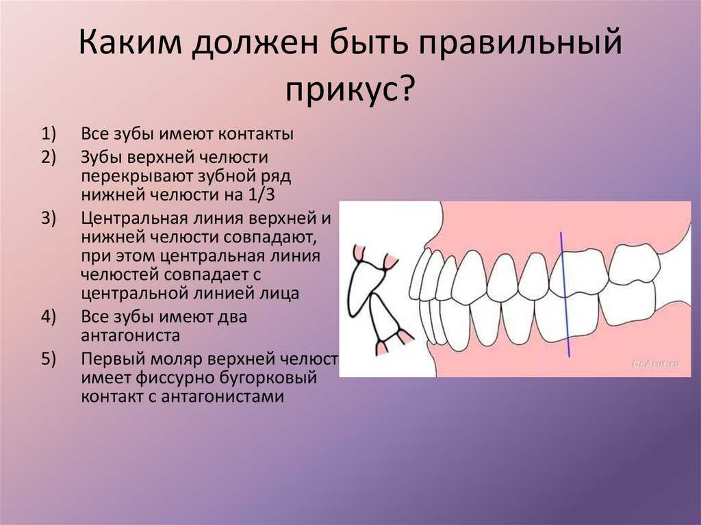 Последствия неправильного прикуса для здоровья человека