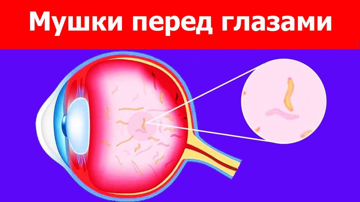 Пленка на глазах у человека: причины и лечение