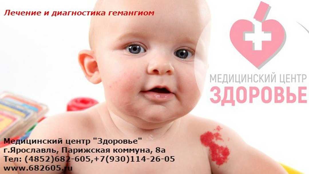 Гемангиомы у детей