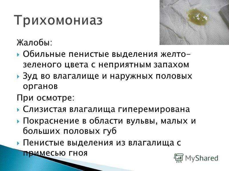 Белые выделения у женщин | eurolab | гинекология