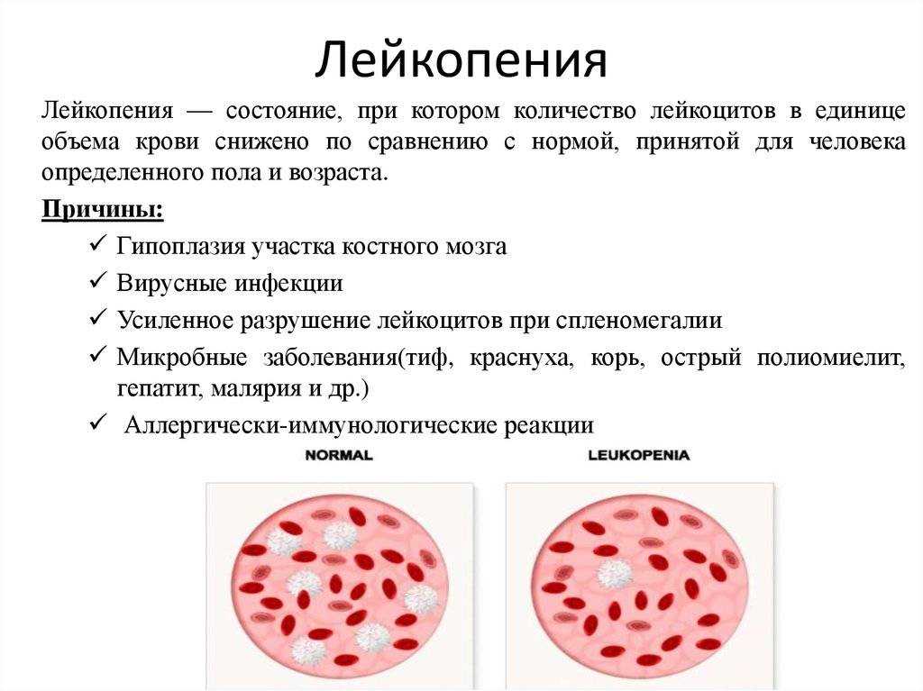 Пониженные лейкоциты причина у мужчин. Лейкоциты. Фрукты для поднятия лейкоцитов. Лейкоциты при аппендиците. Лейкопения.