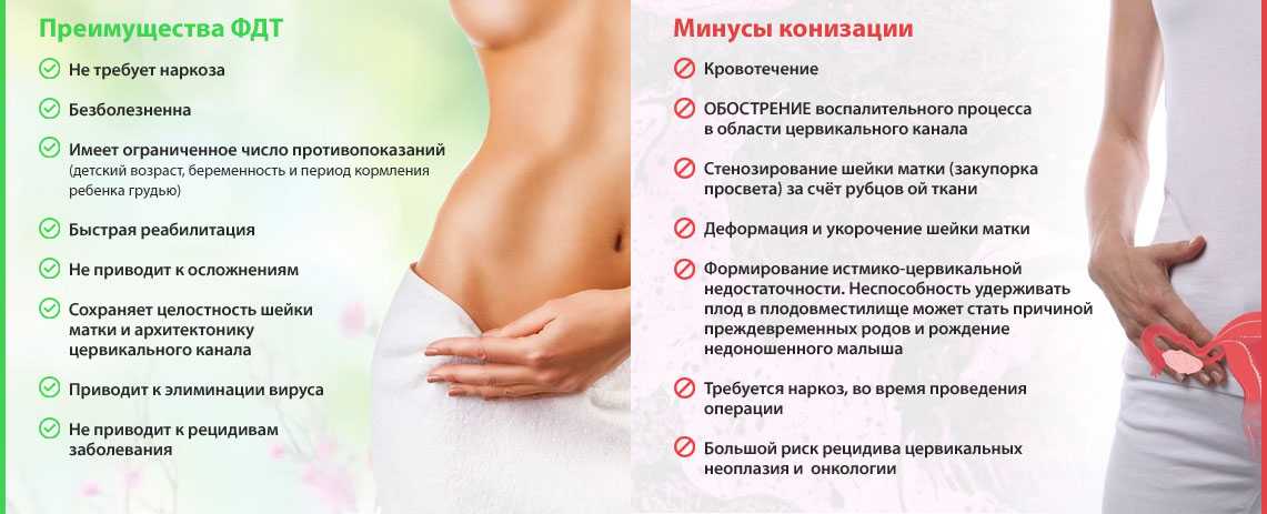 Петлевая эксцизия шейки матки