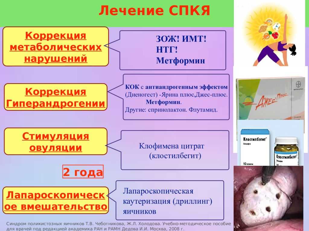 Синдром поликистозных яичников (спкя): важные симптомы, принципы лечения