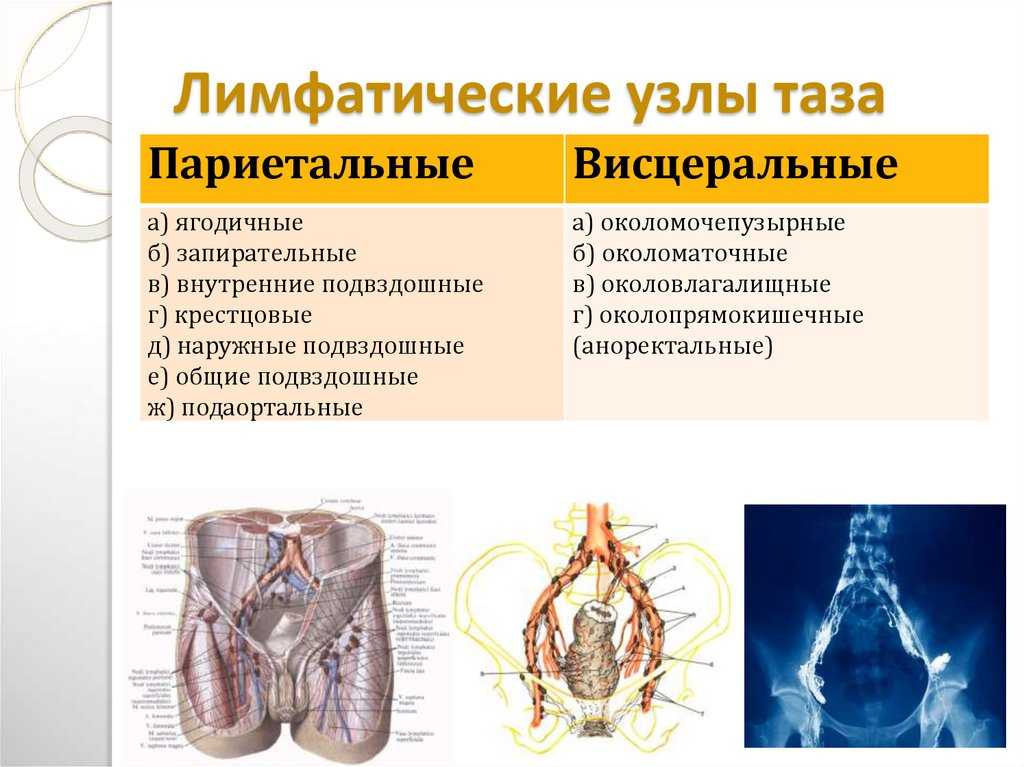 Узи лимфатических узлов что показывает