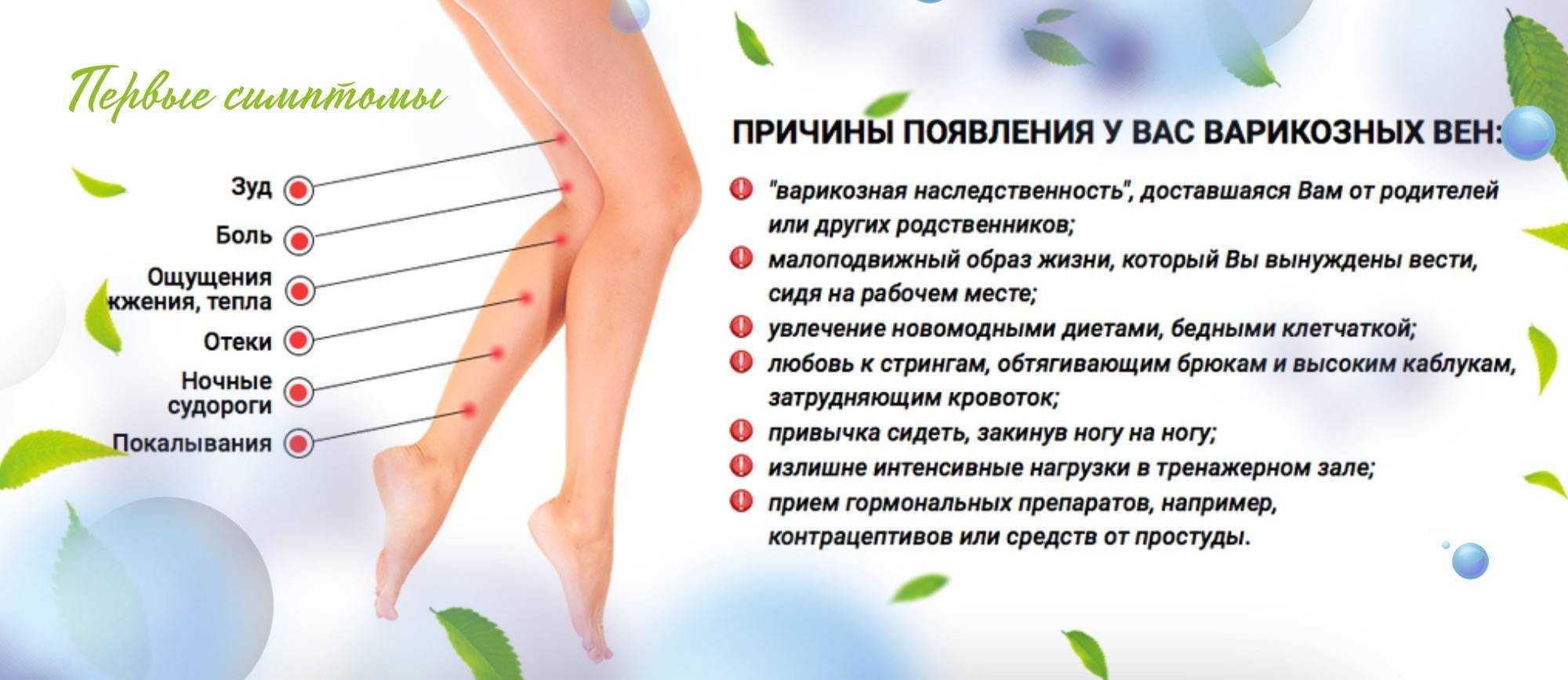 Варикозная болезнь — симптомы, диагностика, лечение | университетская клиника
