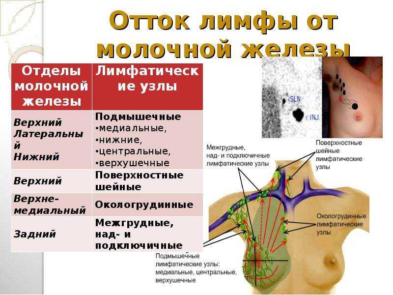 10 фактов, которые вы должны знать о раке молочной железы, если хотите жить * клиника диана в санкт-петербурге