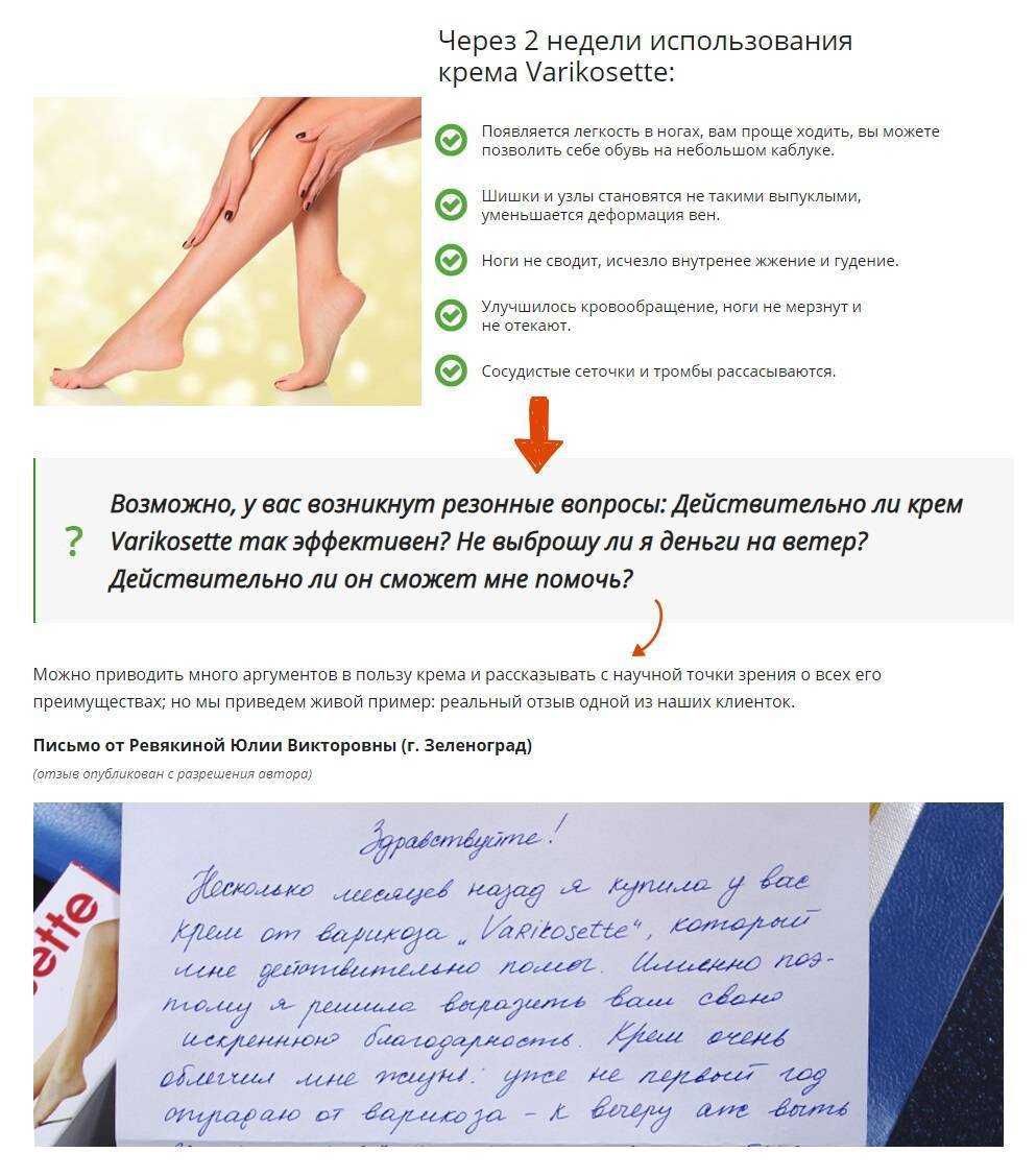 Как понять, что у вас варикоз и пора обращаться к флебологу