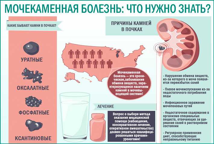 Камни в почках: почему образуются и как лечить?