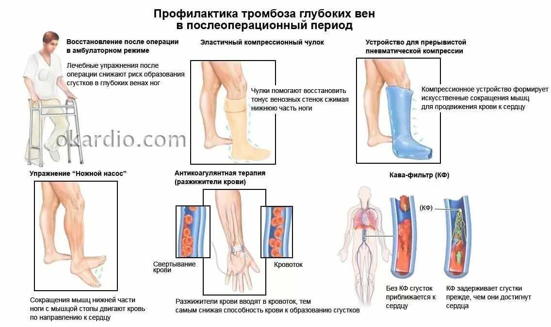 Как происходит удаление вен