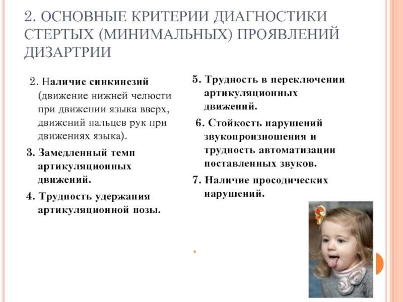 Дизартрия - диалог