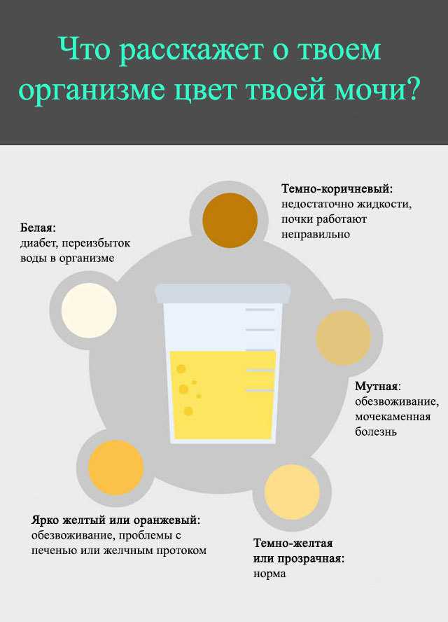 Темная моча: причины