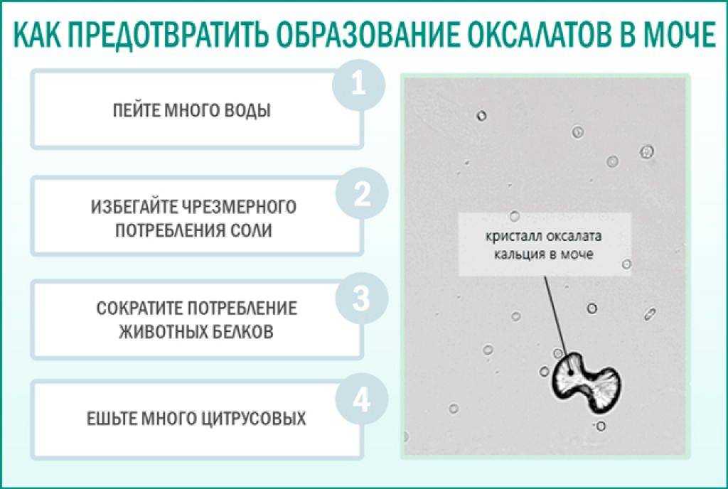 Песок в почках и мочевом пузыре * клиника диана в санкт-петербурге