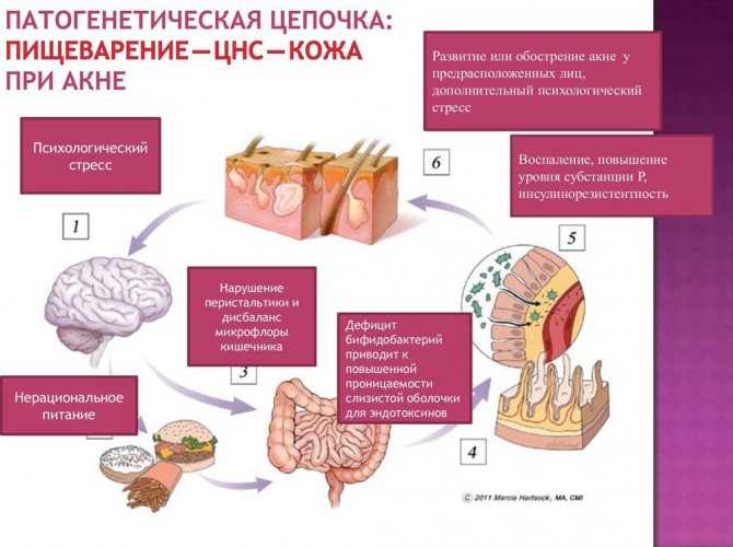 Уход за жирной и проблемной кожей