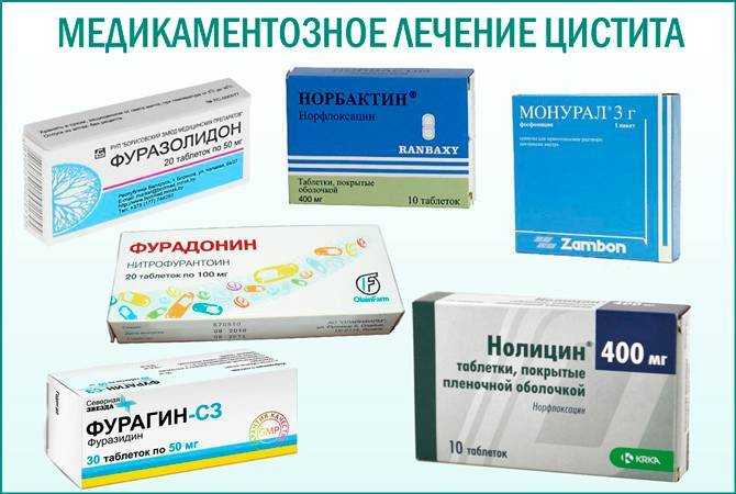 Выделения из половых органов у мужчин