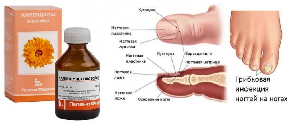 Йод от грибка ногтей на ногах отзывы. Грибок ногтей лекарство. Средство от грибка ногтей. Экстракт от грибка ногтей ног. Средства при грибке ногтя на ногах.