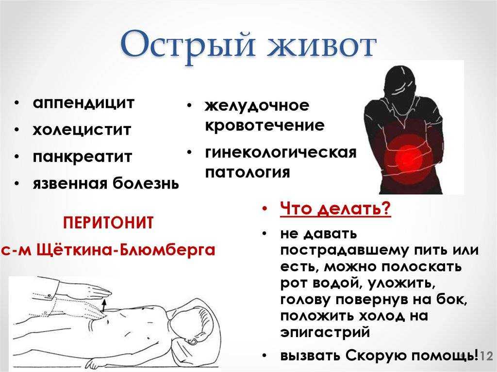 Симптомы аппендицита у взрослых и детей