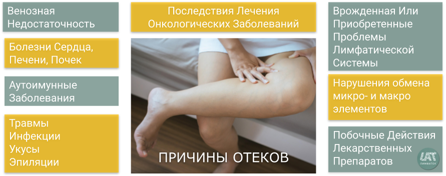 Лимфостаз: медикаментозное лечение лимфостаза нижних конечностей, руки после удаления молочной железы - medside.ru