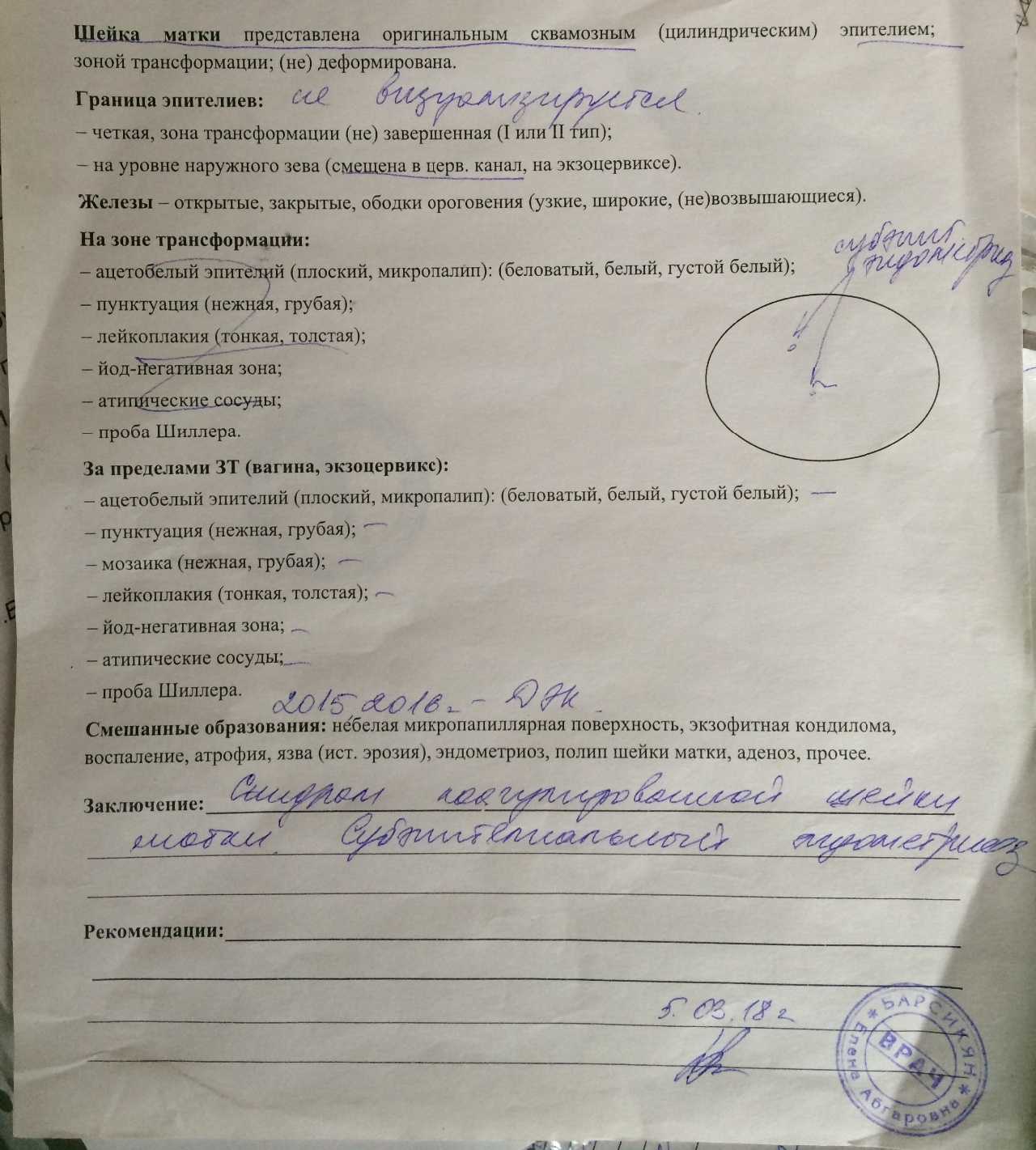 Дисплазия шейки матки