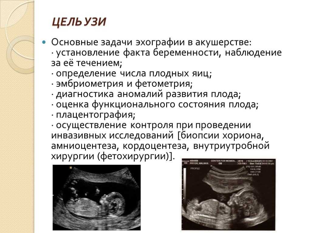 Все пороки плода на узи: таблица развития, расшифровка генетических отклонений * клиника диана в санкт-петербурге